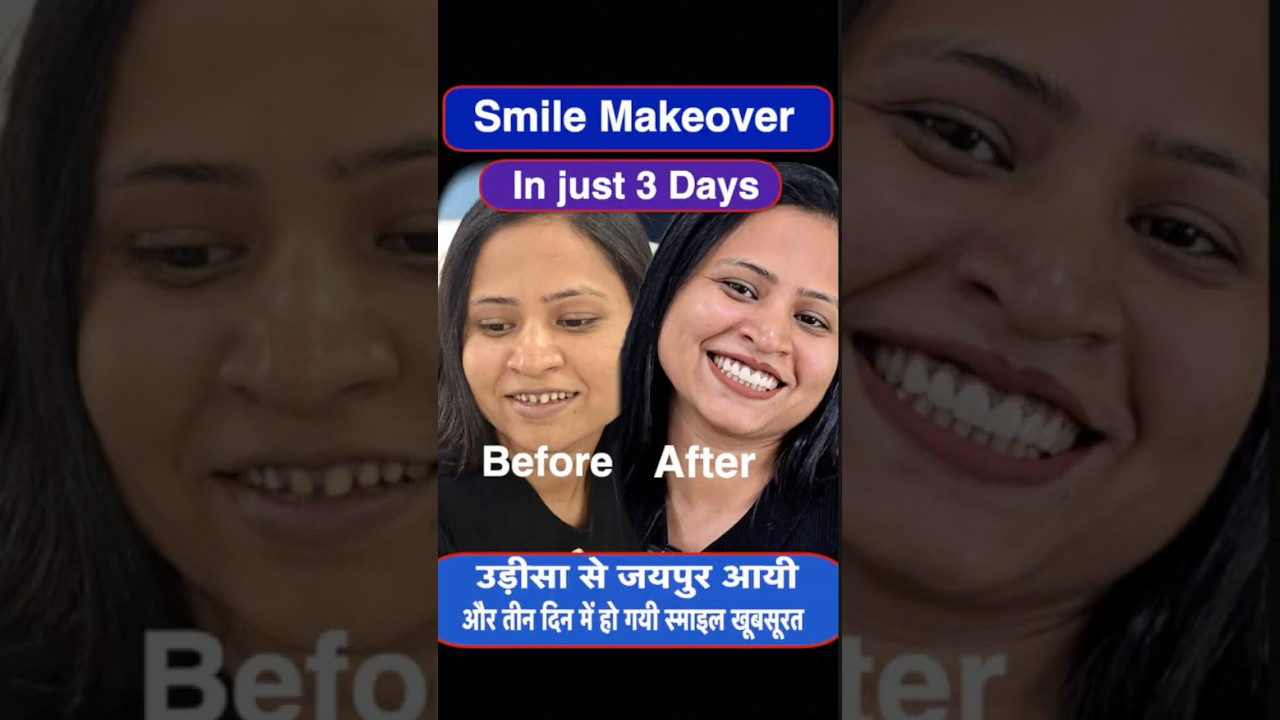 Best Dentist in INDIA for smile Makeover  |Dr. Rajesh Gupta YouDent Hospital Jaipur |