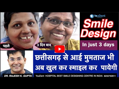 SMILE MAKEOVER IN INDIA |स्माइल को ठीक करें केवल  3  दिनों में |INDIAS BEST SMILE DESIGNING CENTRE|