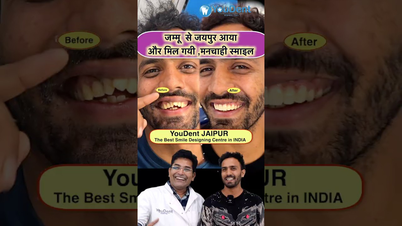 Best Dentist in India for Smile Designing #smilemakeover #drrajeshgupta #youdent