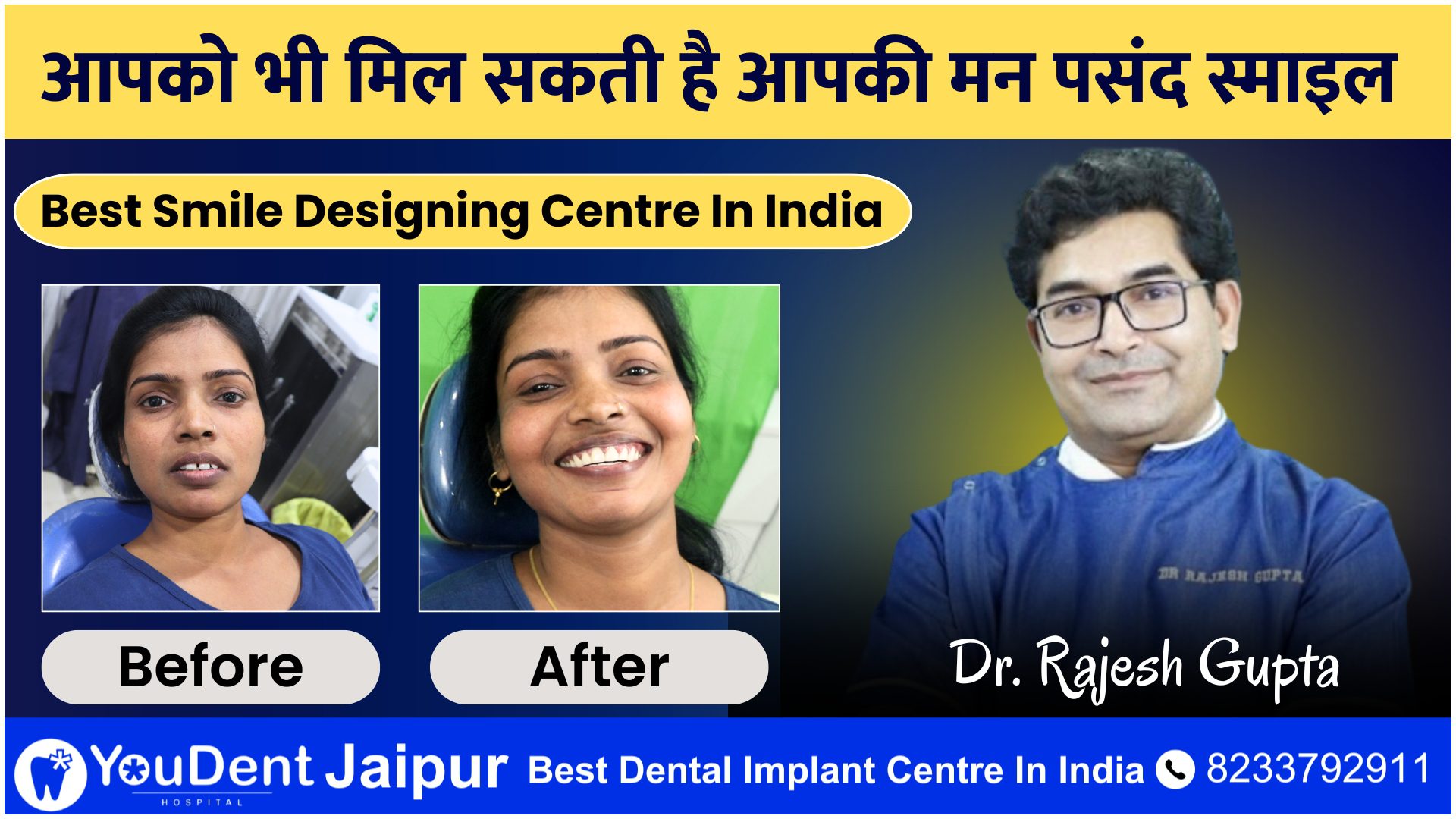 What Is Smile Design Types Treatment Its Cost YouDent What Is Smile Design Types Treatment Its Cost YouDent