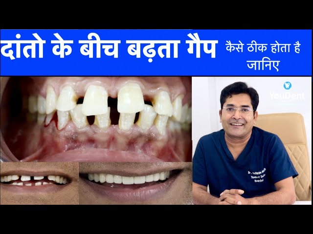Best Dental Clinic In Jaipur