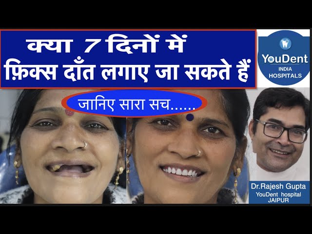 _pBxYfAO4Z4-SD - YouDent Hospital Best Dental Clinic In Jaipur