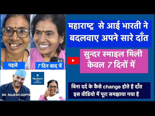 qLJ1sRYkAh8-SD (2) - YouDent Hospital Best Dental Clinic In Jaipur