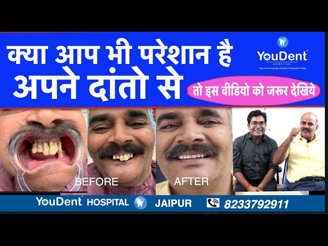 Best Dental Clinic In Jaipur