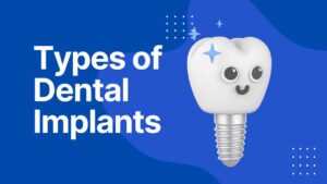 Types of Dental Implant