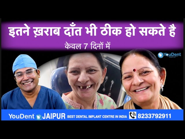 best dental implants in jaipur