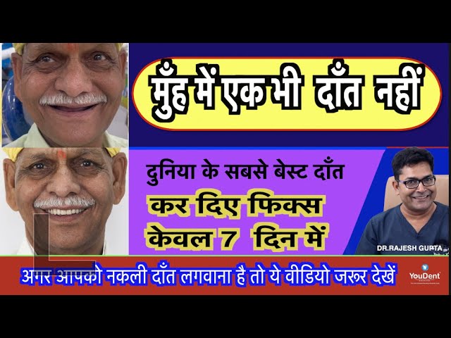 best dental implants in jaipur