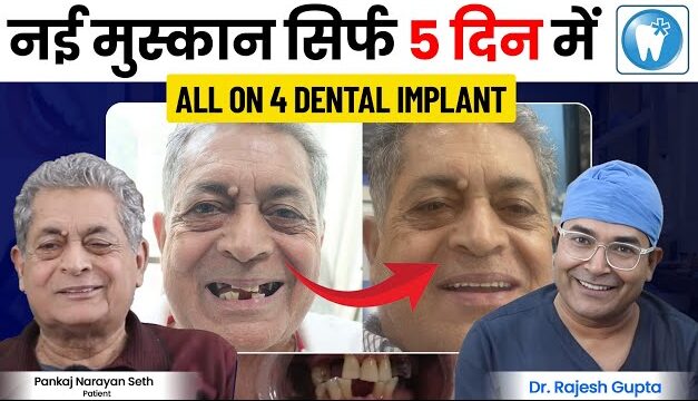 best dental implants in jaipur