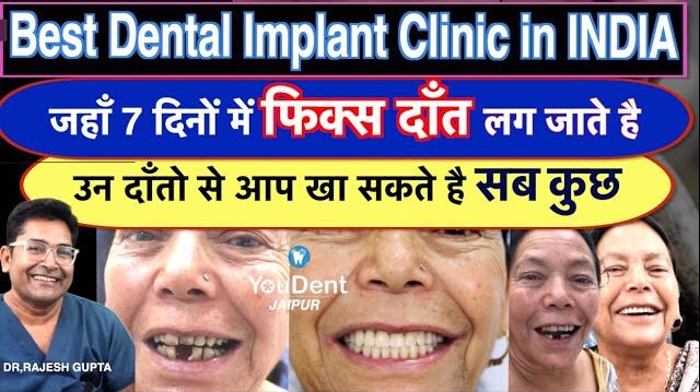 best dental implants in jaipur