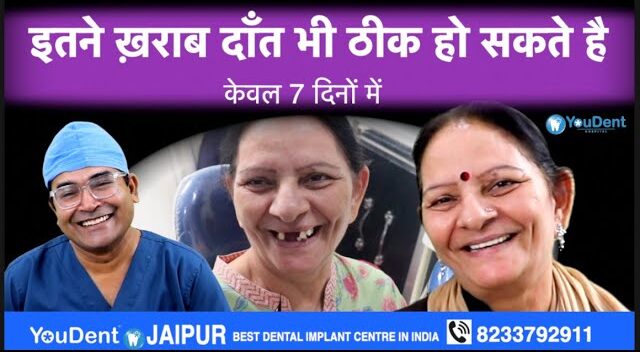 best dental implants in jaipur