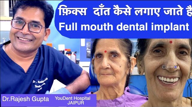 best dental implants in jaipur