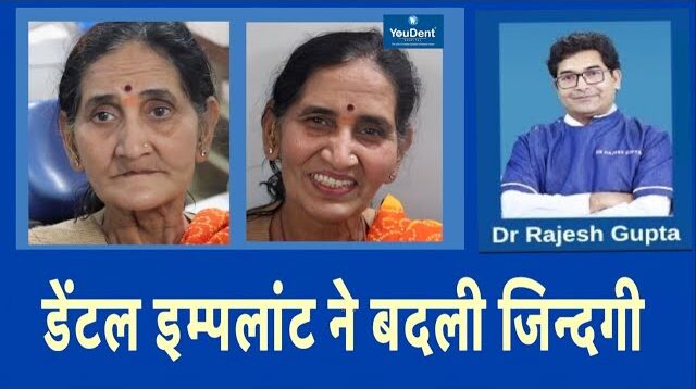best dental implants in jaipur
