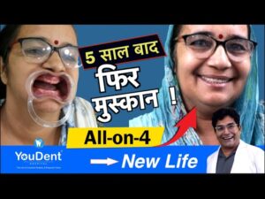 5 साल से बिना दाँत treatment by Rajesh Gupta