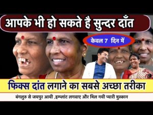 Dental implant Procedure-Phiks daant lagaane ka sabase achchha tareeka