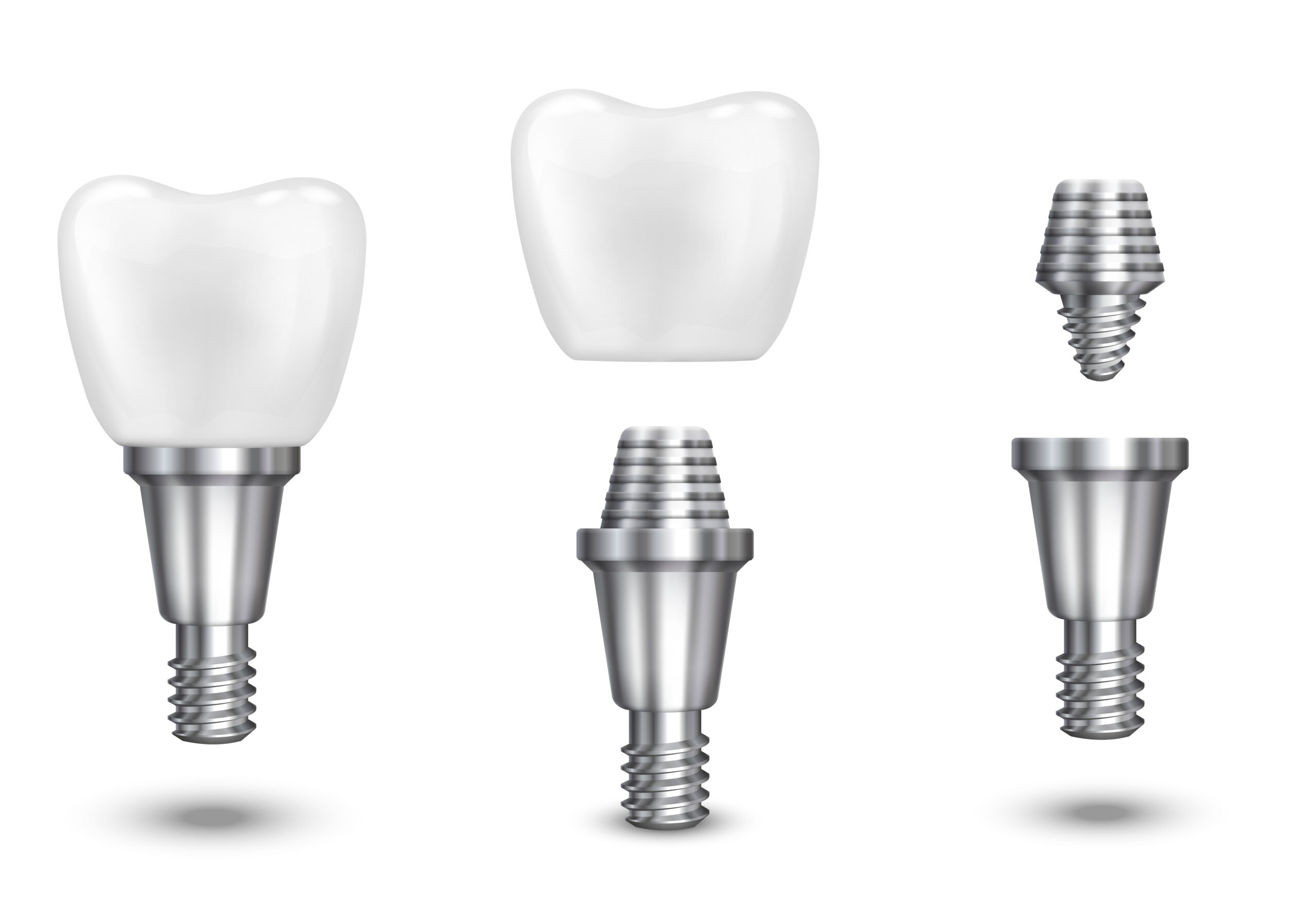 Does Health Insurance Cover Dental Implant Surgery?