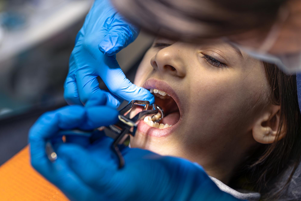Replacing a Missing Tooth