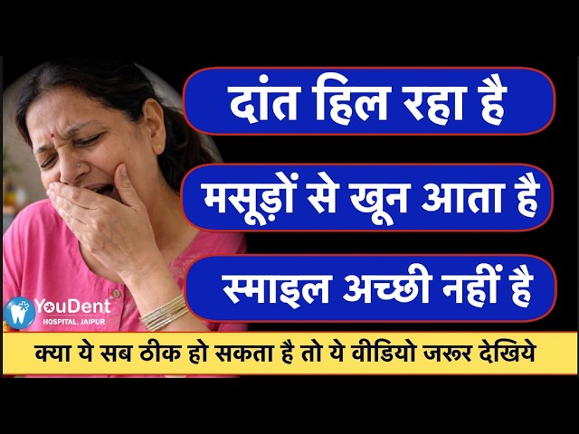 Distressed woman covering her mouth next to three blue Hindi captions about dental issues (teeth healing, gums bleeding, poor smile) and a yellow banner inviting viewers to watch the video; YouDent Jaipur watermark visible.