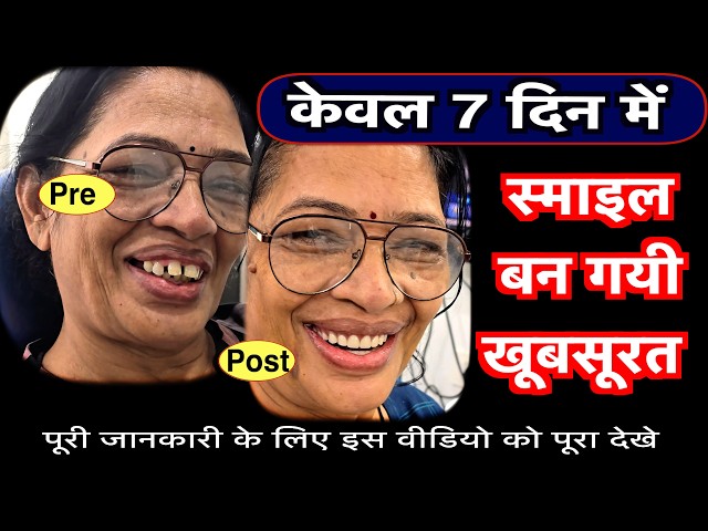 Before-and-after photo of two women with 'Pre' and 'Post' labels, bold Hindi captions about becoming beautiful in 7 days, and a bottom caption inviting viewers to watch the video.