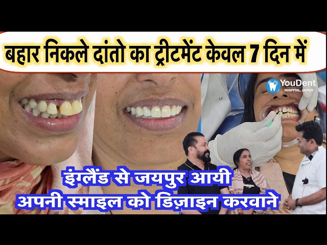 Collage of teeth before/after and a dentist consulting, advertising 7-day dental treatment in Jaipur
