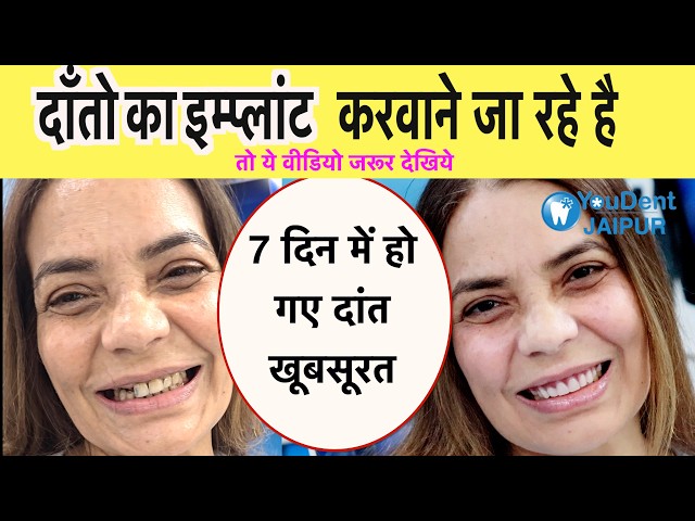 best-dentist-in-jaipur