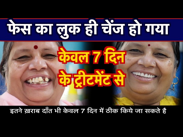 best-dentist-in-jaipur